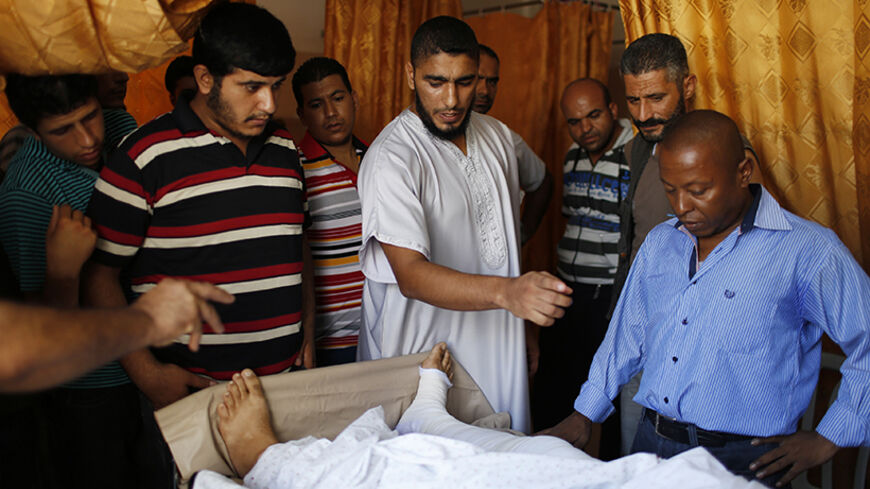 Jamal Doghmosh, a 48-year-old Palestinian mechanic who was injured in an Israeli air strike, receives a visit from relatives and friends at Shifa hospital in Gaza City August 9, 2014. When Doghmosh woke up in hospital after the attack, he could not hear properly and found that three fingers from his right hand were also gone. He is one of thousands of Palestinians who have been left physically disabled by the conflict with Israel in the Gaza Strip, which began on July 8 after a surge in Palestinian rocket s